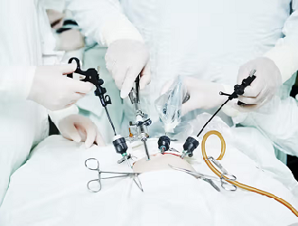 Service-Laparoscopy in Gynecology